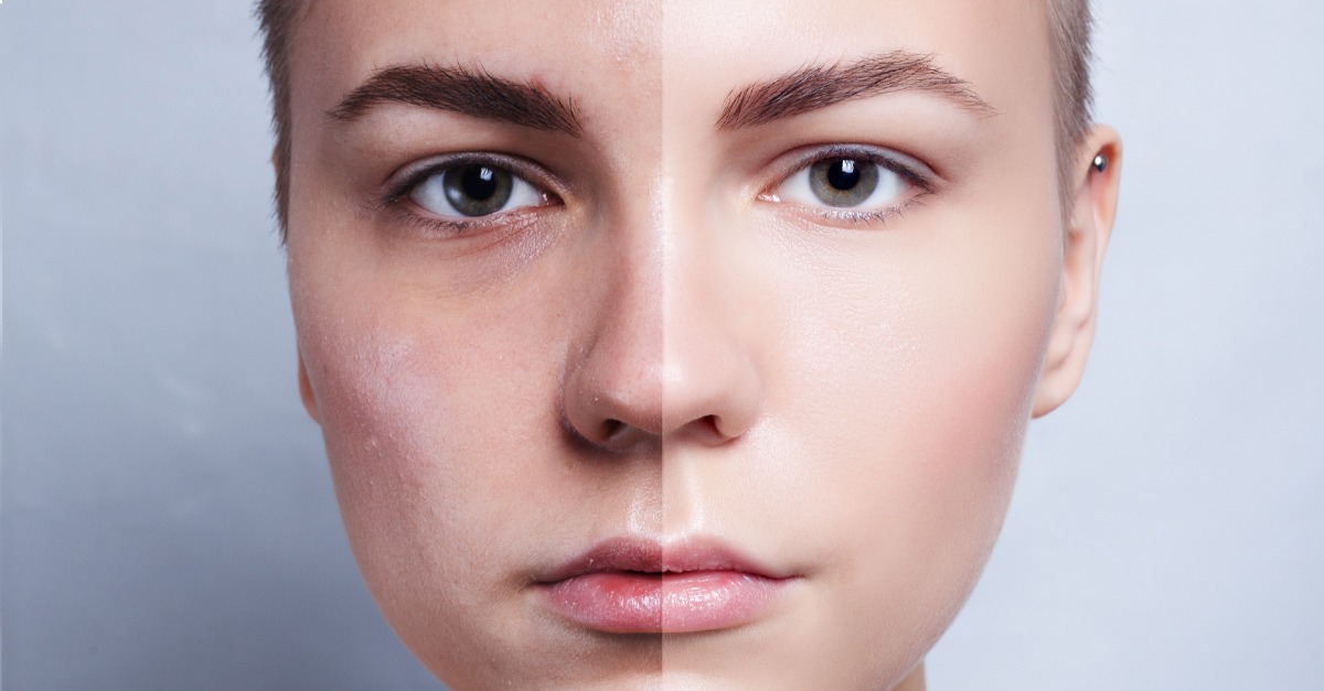 before and after images helping with med spa social media strategy